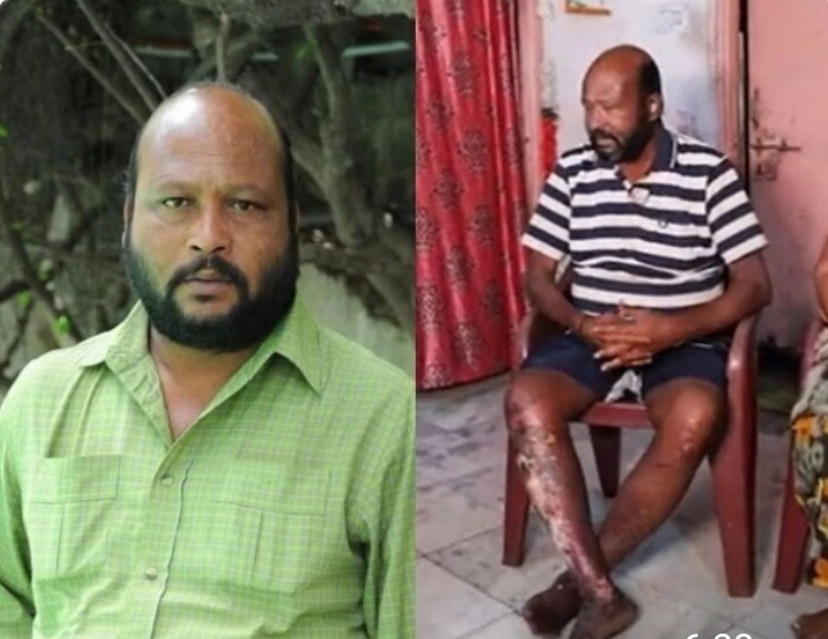 దీనస్థితిలో నటుడు వెంకట్......సాయం కోసం కన్నీళ్లు